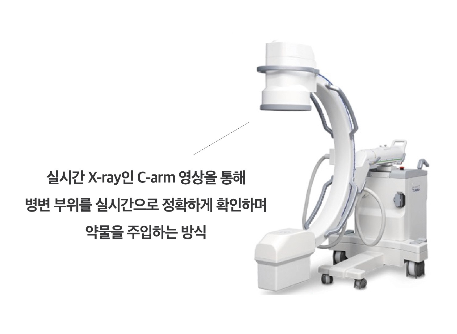 통증완화주사, 신경차단술 C-arm